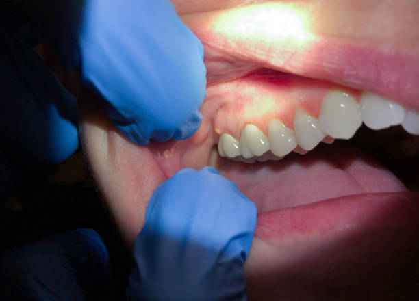 Best Holiday Emergency Dentist in New Sarpy, LA